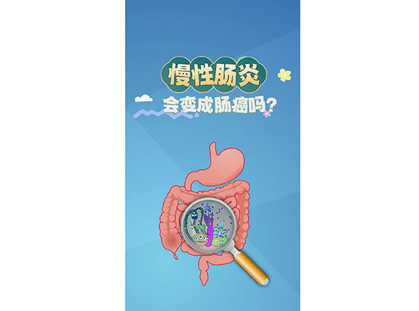 科普在線丨慢性腸炎會變成腸癌嗎？