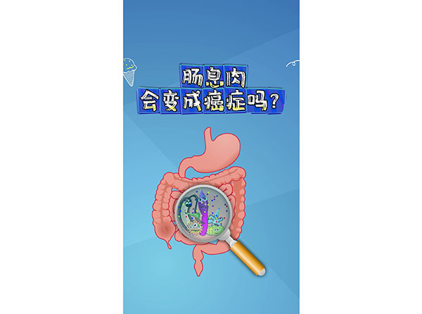 腸息肉會變成癌癥嗎？