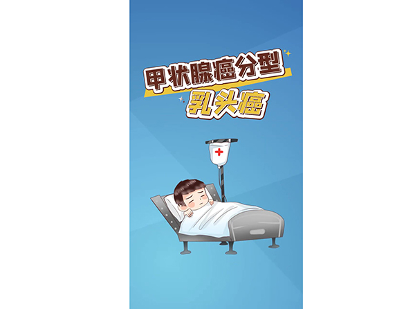 甲狀腺癌分型乳頭癌